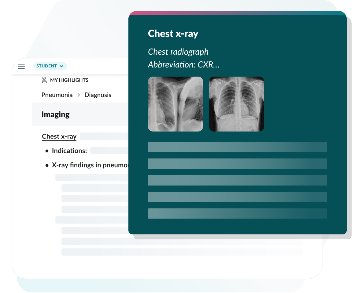 Concept Page: Chest x-ray