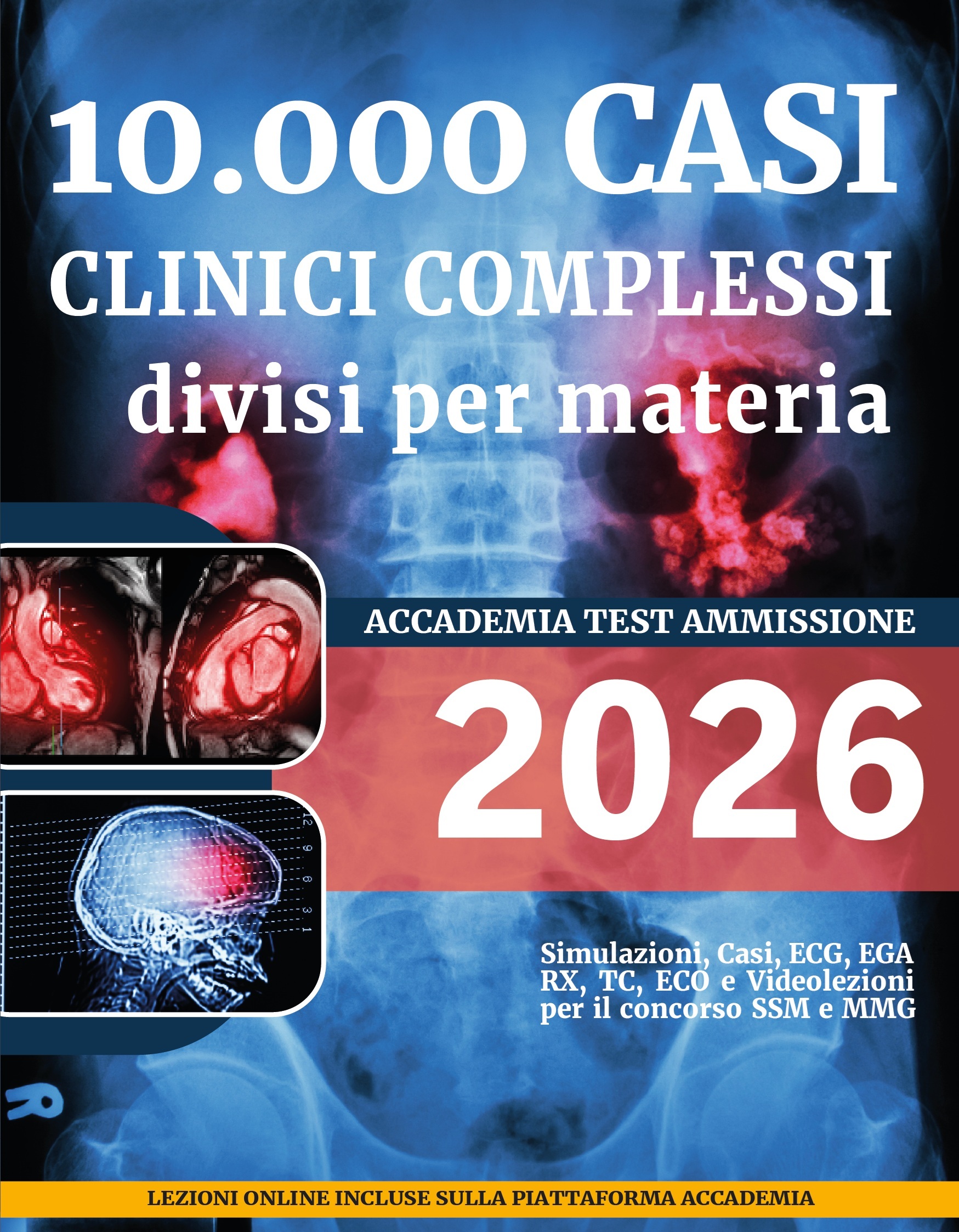 casi