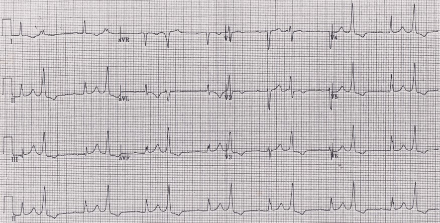 ECG Esercitazione 073