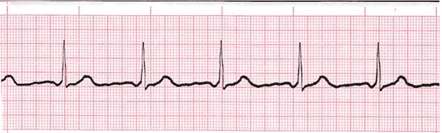 ECG Esercitazione 018