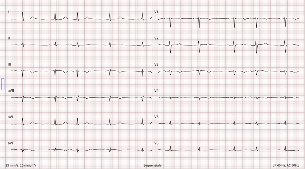 Simulazione Pro 023C (40 ECG)